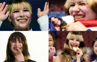 What Does Alysa Liu Have on Her Front Teeth? The Secret Behind Her “Smiley” Piercing